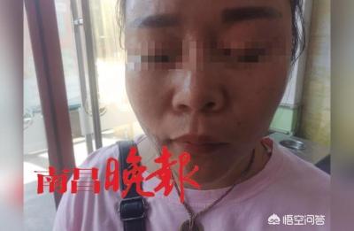 南昌韩美美容医院,南昌哪家正规的医院做祛疤手术比较好
