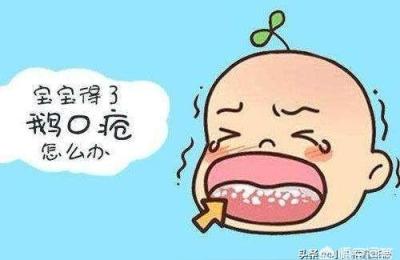 婴儿鹅口疮最佳治疗方法,两个月大的婴儿得了鹅口疮