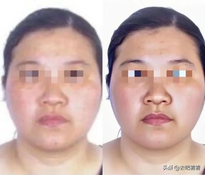 闲鱼找回密码怎么关闭人脸,闲鱼提现需要人脸识别吗